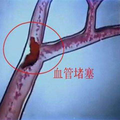 做好“四個(gè)一”，不犯心腦血管?。? /></a></div>
                        </div>
                        <!-- end of typo-img -->
                        <div   id=