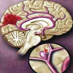 天氣驟變，經(jīng)顱多普勒廠家提醒您謹(jǐn)防心腦血管疾病突發(fā)