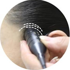 對(duì)于超聲經(jīng)顱多普勒，你了解多少？