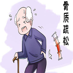 骨密度分析儀在檢查骨密度中有什么作用？