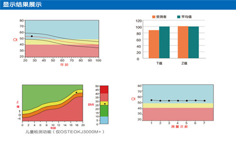 骨密度檢測(cè)儀廠家