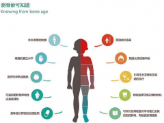 骨生理年齡檢測(cè)儀：兒童多久做一次骨生理年齡檢測(cè)比較好?