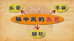 腦中風(fēng)的前兆早知道 經(jīng)顱多普勒幫助檢查腦血管疾病
