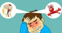 心腦血管疾病癥狀，經顱多普勒盡早檢查