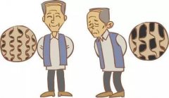 保護骨骼健康，檢查骨密度的日常2大措施