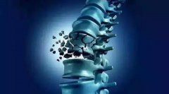 骨骼知識(shí)科普：骨折愈合的三個(gè)階段