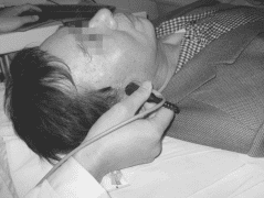 經(jīng)顱多普勒TCD顳窗透聲性差是為啥？